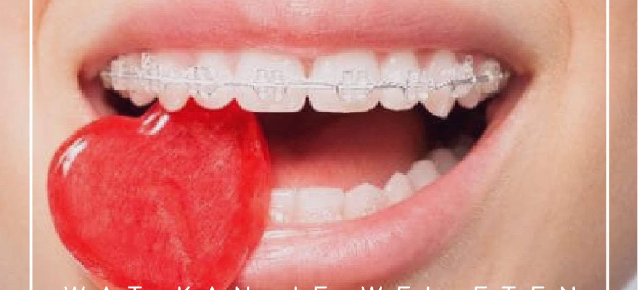 Hoe te eten en drinken met beugels - Comfortho, Smile Into Your Future :)